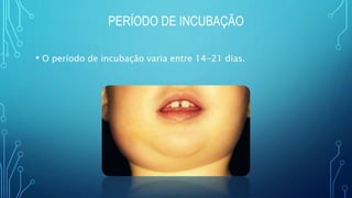 PERÍODO DE INCUBAÇÃO
• O período de incubação varia entre 14-21 dias.
 