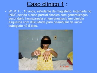 Caso clínico 1  :   W. M. F. , 15 anos, estudante de magistério, internada no INDC devido a crise parcial simples com generalização secundária hemiparesia e hemianestesia em dimidio  esquerda com dificuldade para deambular de início subagudo há 5 dias.  