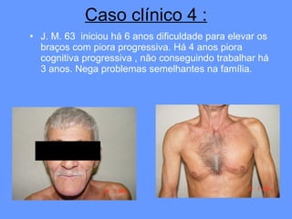Caso clínico 4 : J. M. 63  iniciou há 6 anos dificuldade para elevar os braços com piora progressiva. Há 4 anos piora cognitiva progressiva , não conseguindo trabalhar há 3 anos. Nega problemas semelhantes na família. 