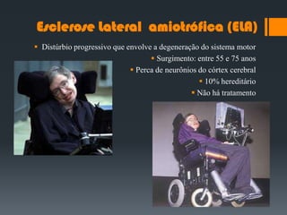 Esclerose Lateral amiotrófica (ELA)
 Distúrbio progressivo que envolve a degeneração do sistema motor
 Surgimento: entre 55 e 75 anos
 Perca de neurônios do córtex cerebral
 10% hereditário
 Não há tratamento
 
