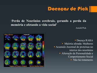 Doenças de Pick
 Doença RARA
 Maioria afetada: Mulheres
 Acumulo Anormal de proteínas no
interior dos neurônios
 Alteração de Personalidade e
Comportamento Social
 Não há tratamento
„Perda de Neurônios cerebrais, gerando a perda da
memória e afetando a vida social’
Arnold Pick
 