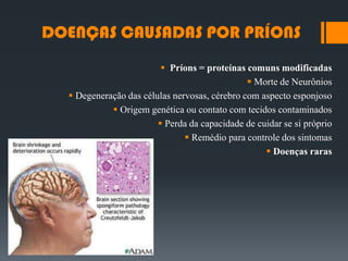 DOENÇAS CAUSADAS POR PRÍONS
 Príons = proteínas comuns modificadas
 Morte de Neurônios
 Degeneração das células nervosas, cérebro com aspecto esponjoso
 Origem genética ou contato com tecidos contaminados
 Perda da capacidade de cuidar se si próprio
 Remédio para controle dos sintomas
 Doenças raras
 