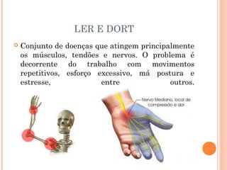 LER E DORT 
 Conjunto de doenças que atingem principalmente 
os músculos, tendões e nervos. O problema é 
decorrente do trabalho com movimentos 
repetitivos, esforço excessivo, má postura e 
estresse, entre outros. 
 