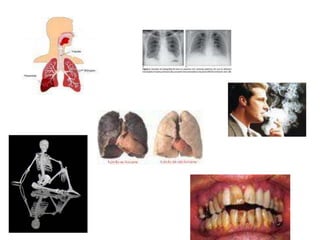 Doenças ocupacionais 