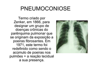 PNEUMOCONIOSE
Termo criado por
Zenker, em 1866, para
designar um grupo de
doenças crônicas do
parênquima pulmonar que
se originam da exposição a
poeiras fibrosantes. Em
1971, este termo foi
redefinido como sendo o
acúmulo de poeiras nos
pulmões + a reação tecidual
a sua presença.
 