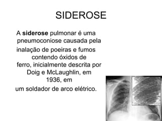 SIDEROSE
A siderose pulmonar é uma
pneumoconiose causada pela
inalação de poeiras e fumos
contendo óxidos de
ferro, inicialmente descrita por
Doig e McLaughlin, em
1936, em
um soldador de arco elétrico.
 
