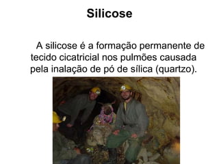 Silicose
A silicose é a formação permanente de
tecido cicatricial nos pulmões causada
pela inalação de pó de sílica (quartzo).
 