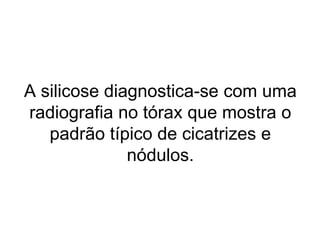 A silicose diagnostica-se com uma
radiografia no tórax que mostra o
padrão típico de cicatrizes e
nódulos.
 