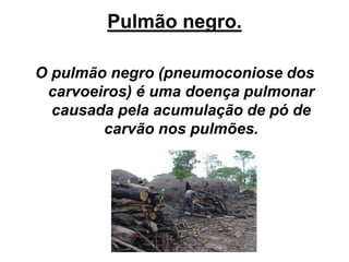 Pulmão negro.
O pulmão negro (pneumoconiose dos
carvoeiros) é uma doença pulmonar
causada pela acumulação de pó de
carvão nos pulmões.
 