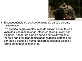 • É consequência da aspiração do pó de carvão durante
muito tempo.
• No pulmão negro simples, o pó do carvão acumula-se à
volta das vias respiratórias inferiores (bronquíolos) dos
pulmões. Apesar de o pó de carvão ser relativamente
inerte e não provocar demasiadas reações, estende-se
por todo o pulmão e numa radiografia observa-se sob a
forma de pequenas manchas.
 