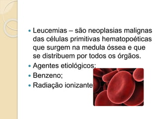  Leucemias – são neoplasias malignas
das células primitivas hematopoéticas
que surgem na medula óssea e que
se distribuem por todos os órgãos.
 Agentes etiológicos:
 Benzeno;
 Radiação ionizantes;
 
