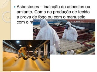  Asbestoses – inalação do asbestos ou
amianto. Como na produção de tecido
a prova de fogo ou com o manuseio
com o mesmo.
 