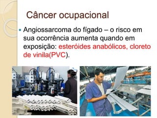 Câncer ocupacional
 Angiossarcoma do fígado – o risco em
sua ocorrência aumenta quando em
exposição: esteróides anabólicos, cloreto
de vinila(PVC).
 