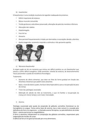b) kwashiorkor
O kwashiorkor é uma condição resultante da ingestão inadequada de proteínas.
   •   Déficit importante de estatura
   •   Massa muscular consumida
   •   Tecido gorduroso subcutâneo preservado, alterações de pele dos membros inferiores
   •   Alterações dos cabelos
   •   Hepatomegalia
   •   Face de lua
   •   Anasarca
   •   Área perineal frequentemente irritada com dermatites e escoriações devido a diarréias
   •   Apatia exagerada, raramente responde a estímulos e não apresenta apetite.




   c) Marasmo-Kwashiorkor
A origem pode ser de um marasmo que entrou em déficit protéico ou um Kwashiorkor que
passou a sofrer déficit energético. Estão presentes: retardo da estatura, do desenvolvimento
neuro psicomotor e queda da resistência imunológica.
Tratamento
   •   Aumento de oferta alimentar, que deve ser feito de forma gradual em função dos
       distúrbios intestinais que podem estar presentes
   •   Após a reversão deste quadro, fornecer dieta hipercalórica para a recuperação do peso
       da criança
   •   Tratar das patologias associadas
   •   Obtenção de adesão da mãe ao tratamento, o que irá facilitar a recuperação da
       criança em menor tempo e com maior intensidade.



   2- Anemia

Patologia ocasionada pela queda da proporção de glóbulos vermelhos (hemácias) ou de
hemoglobina no sangue. Temos vários tipos de anemia, mas a mais comum é a causada pela
deficiência de ferro no organismo - a chamada anemia ferropriva, ou pela deficiência de ácido
fólico – anemia perniciosa ou megaloblástica.
O ferro é elemento indispensável na composição dos glóbulos vermelhos, responsáveis pela
oxigenação dos tecidos do corpo.
O déficit de ferro é em geral provocado por erros alimentares.
 