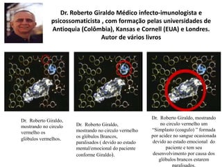 Dr. Roberto Giraldo Médico infecto-imunologista e
              psicossomaticista , com formação pelas universidades de
              Antioquia (Colômbia), Kansas e Cornell (EUA) e Londres.
                                Autor de vários livros




                                                        Dr. Roberto Giraldo, mostrando
Dr. Roberto Giraldo,
                       Dr. Roberto Giraldo,                  no circulo vermelho um
mostrando no circulo
                       mostrando no circulo vermelho    “Simplasto (coagulo) ” formada
vermelho os
                       os glóbulos Brancos,             por acidez no sangue ocasionada
glóbulos vermelhos.
                       paralisados ( devido ao estado   devido ao estado emocional do
                       mental/emocional do paciente            paciente e tem seu
                       conforme Giraldo).                desenvolvimento por causa dos
                                                            glóbulos brancos estarem
                                                                   paralisados.
 