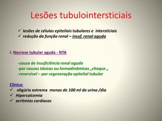 Lesões tubulointersticiais
 lesões de células epiteliais tubulares e intersticiais
 redução da função renal – insuf. renal aguda
I. Necrose tubular aguda - NTA
-causa de insuficiência renal aguda
-por causas tóxicas ou hemodinâmicas „choque „
-reversível – por regeneração epitelial tubular
Clínica:
 oligúria extrema menos de 100 ml de urina /dia
 Hipercalcemia
 arritmias cardíacas
 