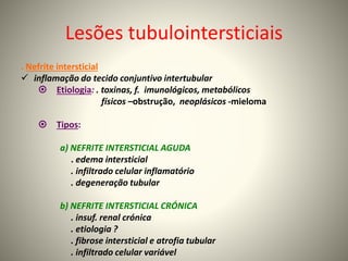 Lesões tubulointersticiais
. Nefrite intersticial
 inflamação do tecido conjuntivo intertubular
 Etiologia: . toxinas, f. imunológicos, metabólicos
físicos –obstrução, neoplásicos -mieloma
 Tipos:
a) NEFRITE INTERSTICIAL AGUDA
. edema intersticial
. infiltrado celular inflamatório
. degeneração tubular
b) NEFRITE INTERSTICIAL CRÓNICA
. insuf. renal crónica
. etiologia ?
. fibrose intersticial e atrofia tubular
. infiltrado celular variável
 