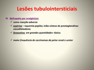 Lesões tubulointersticiais
III. Nefropatia por analgésicos
 como reacção adversa
 aspirina – isquemia papilar, inibe síntese de prostaglandinas
vasodilatadoras
 fenacetina em grandes quantidades- tóxica
 maior frequência de carcinomas da pelve renal e ureter
 