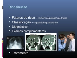 Rinosinusite
 Fatores de risco – IVAS/rinite/polipos/hipertrofias
 Classificação – aguda/subaguda/crônica
 Diagnóstico
 Exames complementares

 Tratamento

 