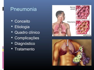 Pneumonia
 Conceito
 Etiologia
 Quadro clínico
 Complicações
 Diagnóstico
 Tratamento

 