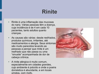 Rinite
●   Rinite é uma inflamação das mucosas
    do nariz. Várias pessoas têm a doença,
    cuja incidência é de 4 em cada 10
    pacientes, tanto adultos quanto
    crianças.
●   As causas são várias: desde resfriados,
    produtos químicos, irritantes, até
    medicamentos e alergia. Seus sintomas
    são muito parecidos levando as
    pessoas a pensar que rinite é um
    resfriado que não passa ou uma
    “sinusite” acompanhada de dor de
    cabeça crônica.
●   A rinite alérgica é muito comum,
    especialmente em cidades grandes,
    cujo ambiente é poluído e onde a poeira
    doméstica é abundante, e em locais
    úmidos, com mofo.
 