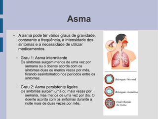 Asma
● A asma pode ter vários graus de gravidade,
consoante a frequência, a intensidade dos
sintomas e a necessidade de utilizar
medicamentos.
– Grau 1: Asma intermitente
Os sintomas surgem menos de uma vez por
semana ou o doente acorda com os
sintomas duas ou menos vezes por mês,
ficando assintomático nos períodos entre os
sintomas.
– Grau 2: Asma persistente ligeira
Os sintomas surgem uma ou mais vezes por
semana, mas menos de uma vez por dia. O
doente acorda com os sintomas durante a
noite mais de duas vezes por mês.
 