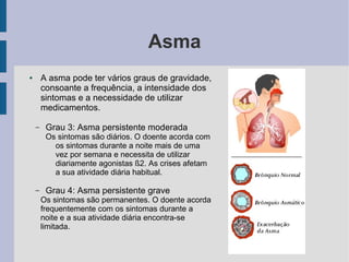 Asma
● A asma pode ter vários graus de gravidade,
consoante a frequência, a intensidade dos
sintomas e a necessidade de utilizar
medicamentos.
– Grau 3: Asma persistente moderada
Os sintomas são diários. O doente acorda com
os sintomas durante a noite mais de uma
vez por semana e necessita de utilizar
diariamente agonistas ß2. As crises afetam
a sua atividade diária habitual.
– Grau 4: Asma persistente grave
Os sintomas são permanentes. O doente acorda
frequentemente com os sintomas durante a
noite e a sua atividade diária encontra-se
limitada.
 