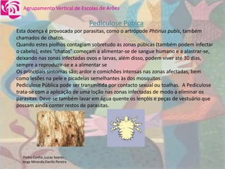 DoençAs Sexualmente..