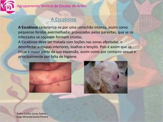 DoençAs Sexualmente..