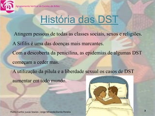 DoençAs Sexualmente..