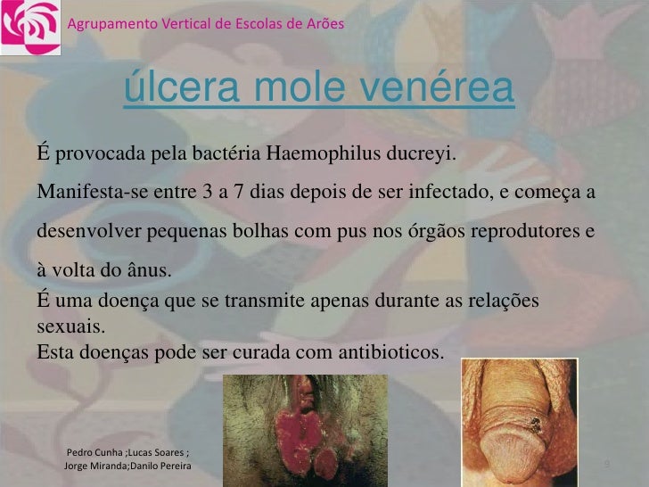 DoençAs Sexualmente.. DoençAs Sexualmente..