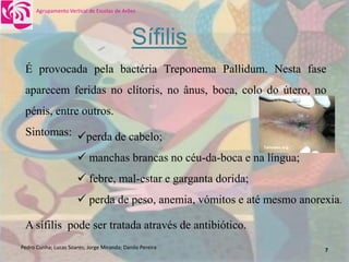 DoençAs Sexualmente..