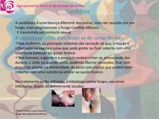 DoençAs Sexualmente..