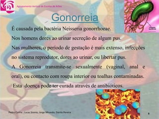 DoençAs Sexualmente..