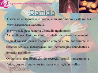 DoençAs Sexualmente..