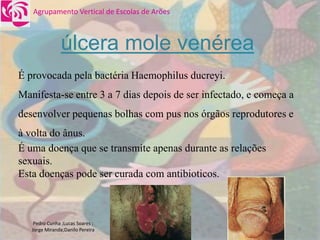 DoençAs Sexualmente..