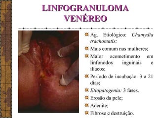 LLIINNFFOOGGRRAANNUULLOOMMAA 
VVEENNÉÉRREEOO 
Ag. Etiológico: Chamydia 
trachomatis; 
Mais comum nas mulheres; 
Maior acometimento em 
linfonodos inguinais e 
ilíacos; 
Período de incubação: 3 a 21 
dias; 
Etiopatogenia: 3 fases. 
Erosão da pele; 
Adenite; 
Fibrose e destruição. 
 