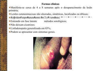 FFoorrmmaass ccllíínniiccaass 
Manifesta-se cerca de 4 a 8 semanas após o desaparecimento da lesão 
primária; 
Lesões cutaneomucosas não ulceradas, simétricas, localizadas ou difusas; 
Regridem espontaneamente em 2 a 6 semanas; 
Entrando em fase latente métodos sorológicos; 
Não deixam cicatrizes; 
Linfadenopatia generalizada em 85%; 
Podem se apresentar com sintomas gerais. 
 