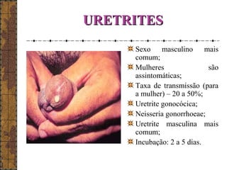 UURREETTRRIITTEESS 
Sexo masculino mais 
comum; 
Mulheres são 
assintomáticas; 
Taxa de transmissão (para 
a mulher) – 20 a 50%; 
Uretrite gonocócica; 
Neisseria gonorrhoeae; 
Uretrite masculina mais 
comum; 
Incubação: 2 a 5 dias. 
 