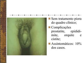 Sem tratamento piora 
do quadro clínico; 
Complicações 
prostatite, epididi-mite, 
orquite e 
cistite; 
Assintomáticos: 10% 
dos casos. 
 
