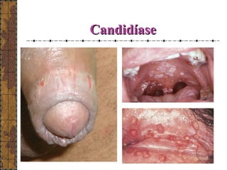 CCaannddiiddííaassee 
 