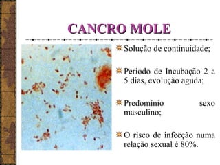 CCAANNCCRROO MMOOLLEE 
Solução de continuidade; 
Período de Incubação 2 a 
5 dias, evolução aguda; 
Predomínio sexo 
masculino; 
O risco de infecção numa 
relação sexual é 80%. 
 