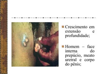 Crescimento em 
extensão e 
profundidade; 
Homem – face 
interna do 
prepúcio, meato 
uretral e corpo 
do pênis; 
 
