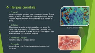  Herpes Genitais
 O que é?
Afetam os órgãos genitais e as zonas envolventes. É uma
doença que não tem cura e é causada pelo vírus Herpes
Simplex. Apenas existem medicamentos que aliviam as
dores.
 Sintomas
O herpes caracteriza-se por vesículas, em forma de
cacho, que aparecem 4 - 5 dias após o contágio, que
acabam por rebentar e deixar a carne a descoberto. São
acompanhadas por um ardor intenso.
 Formas de Contágio
Transmite-se por contacto sexual
 Prevenção
Abstenção de relações sexuais enquanto durem os
sintomas.

Herpes simplex tipo 2

 