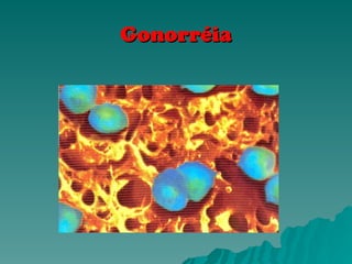 Gonorréia
Gonorréia
 