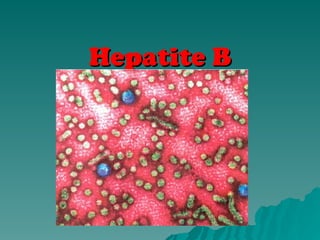Hepatite B
Hepatite B
 