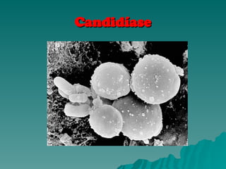 Candidíase
Candidíase
 