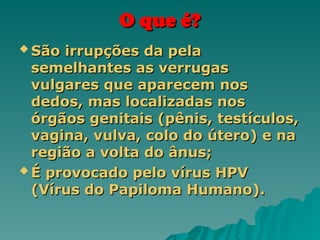 O que é?
O que é?
 São irrupções da pela
São irrupções da pela
semelhantes as verrugas
semelhantes as verrugas
vulgares que aparecem nos
vulgares que aparecem nos
dedos, mas localizadas nos
dedos, mas localizadas nos
órgãos genitais (pênis, testículos,
órgãos genitais (pênis, testículos,
vagina, vulva, colo do útero) e na
vagina, vulva, colo do útero) e na
região a volta do ânus;
região a volta do ânus;
 É provocado pelo vírus HPV
É provocado pelo vírus HPV
(Vírus do Papiloma Humano).
(Vírus do Papiloma Humano).
 