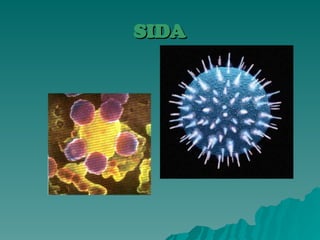 SIDA
SIDA
 