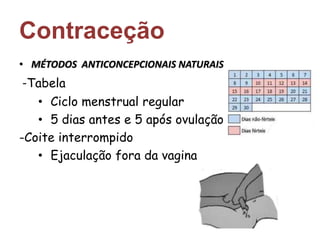 Contraceção 
• MÉTODOS ANTICONCEPCIONAIS NATURAIS 
-Tabela 
• Ciclo menstrual regular 
• 5 dias antes e 5 após ovulação 
-Coite interrompido 
• Ejaculação fora da vagina 
 